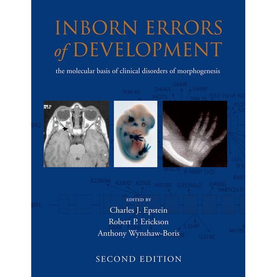 Inborn Errors of Development de Charles J. Epstein