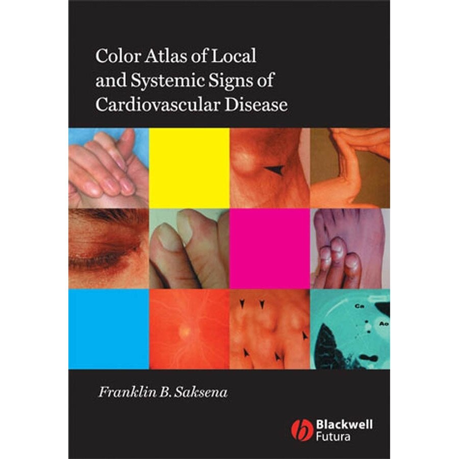 Color Atlas of Local and Systemic Manifestations of Cardiovascular Disease de Franklin B. Saksena