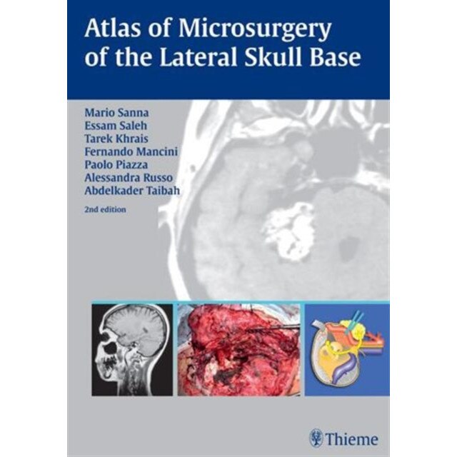 Atlas of Microsurgery of the Lateral Skull Base de Mario Sanna