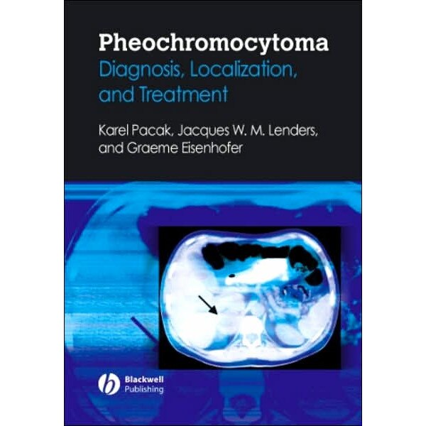 Pheochromocytoma de Karel Pacak