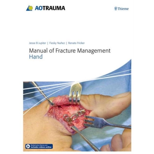 Manual of Fracture Management - Hand de Jesse B. Jupiter