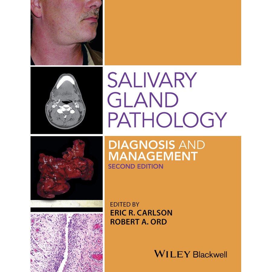Salivary Gland Pathology de Eric Carlson