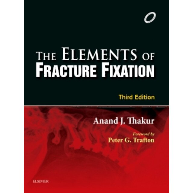 Elements of Fracture Fixation de Anand J. Thakur