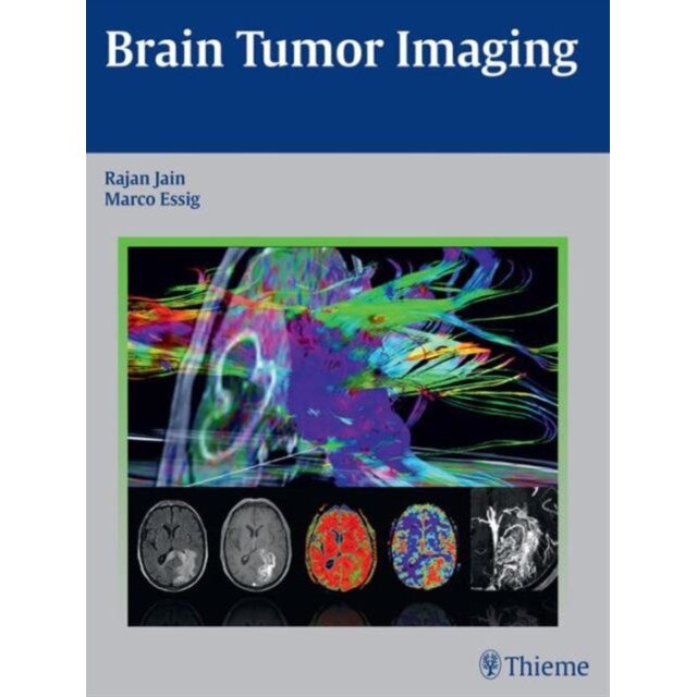 Brain Tumor Imaging de Rajan Jain