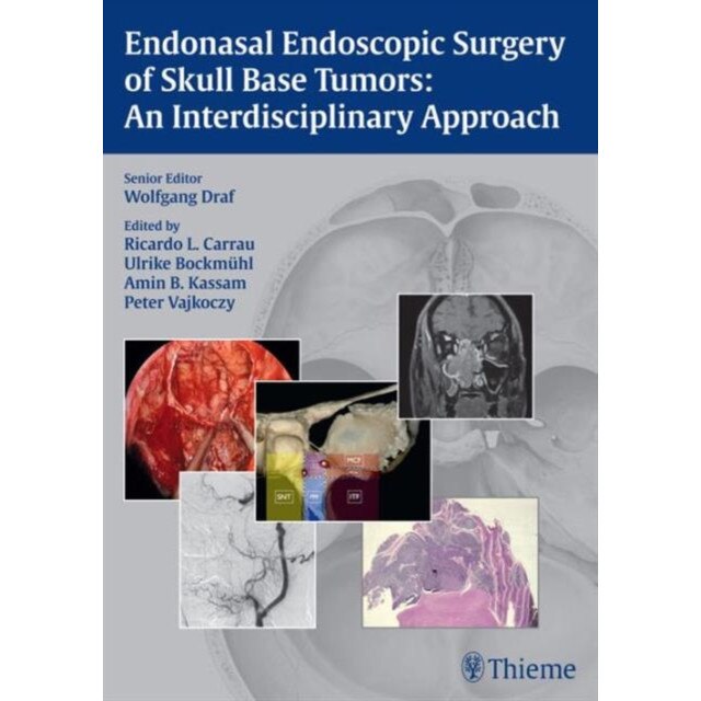 Endonasal Endoscopic Surgery of Skull Base Tumors de Wolfgang Draf