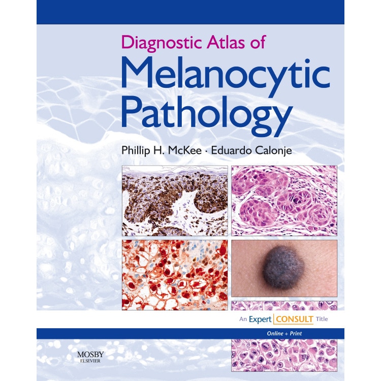 Diagnostic Atlas of Melanocytic Pathology de Phillip H. McKee