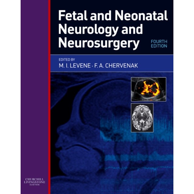 Fetal and Neonatal Neurology and Neurosurgery de Malcolm I. Levene