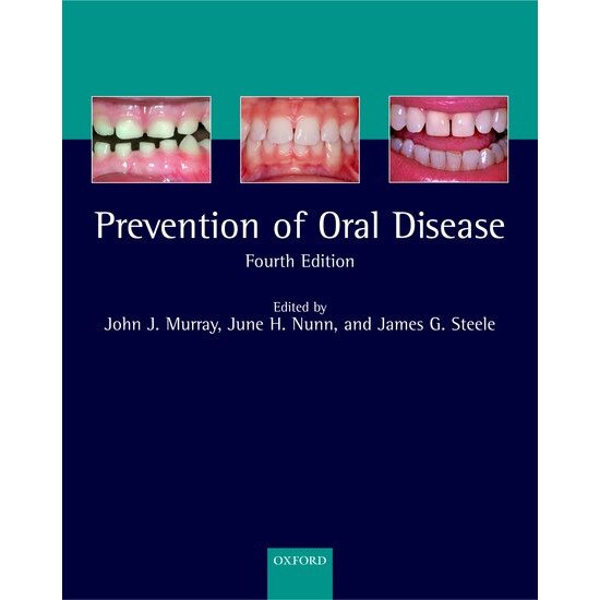 The Prevention of Oral Disease de John J Murray CBE