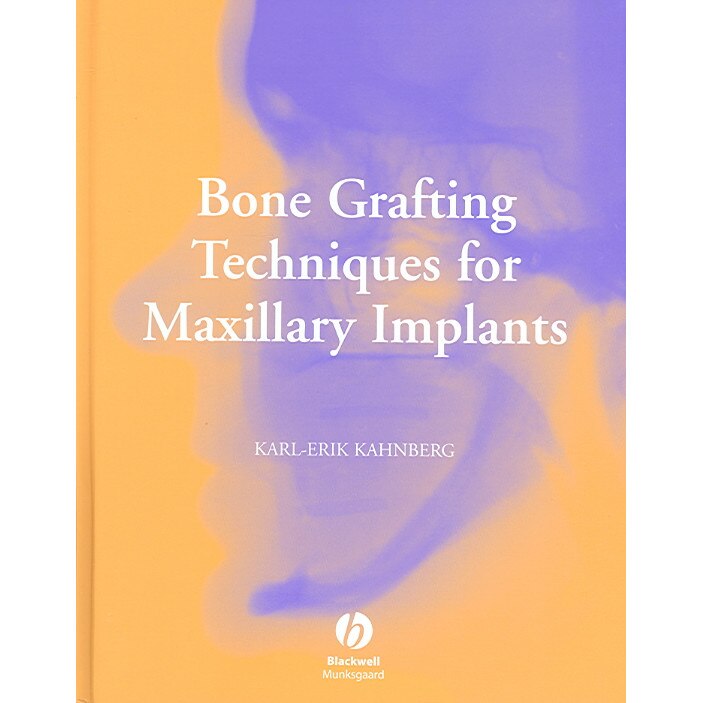 Bone Grafting Techniques for Maxillary Implants de Karl/-/Erik Kahnberg