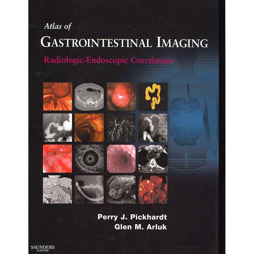 Atlas of Gastrointestinal Imaging: Radiologic-Endoscopic Correlation de Perry J. Pickhardt