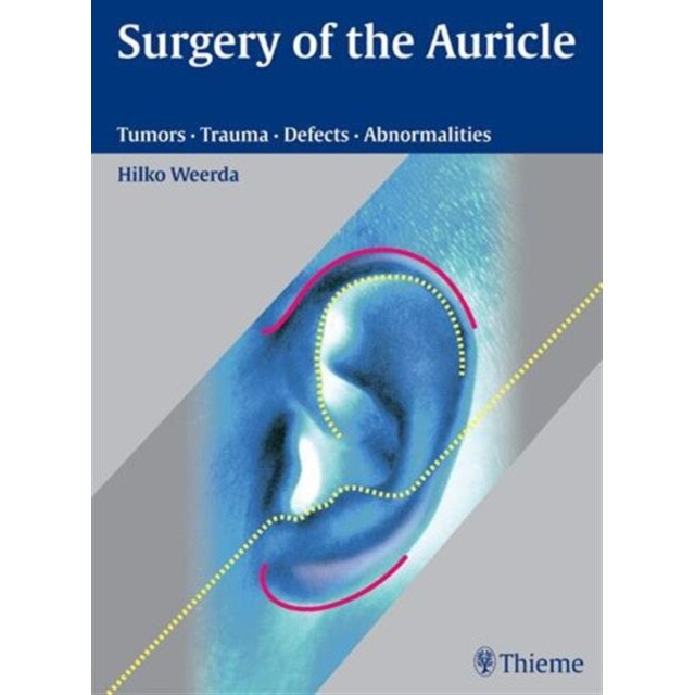 Surgery of the Auricle de Hilko Weerda