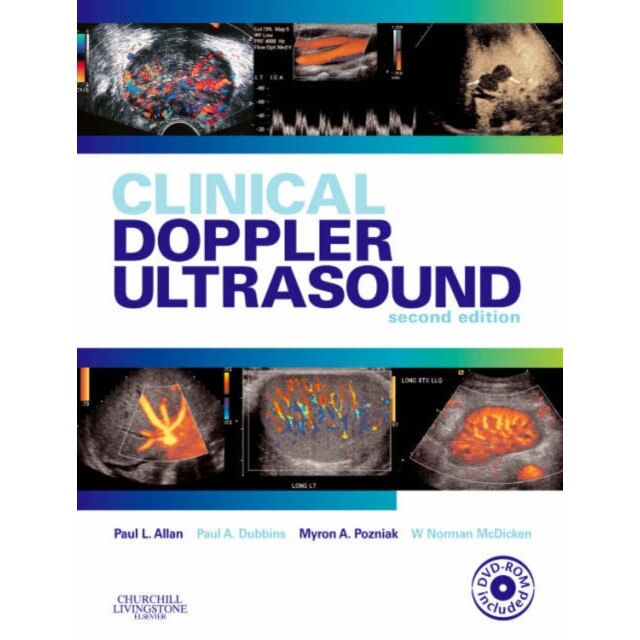 Clinical Doppler Ultrasound de Paul L. Allan