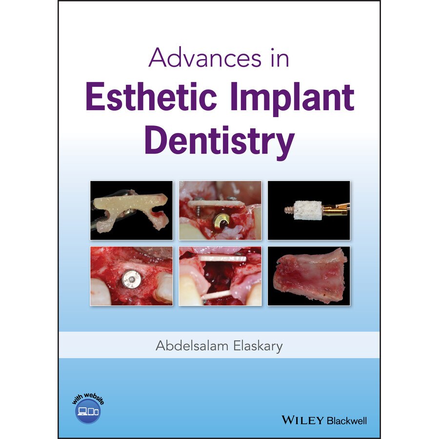 Advances in Esthetic Implant Dentistry de Abdelsalam Elaskary