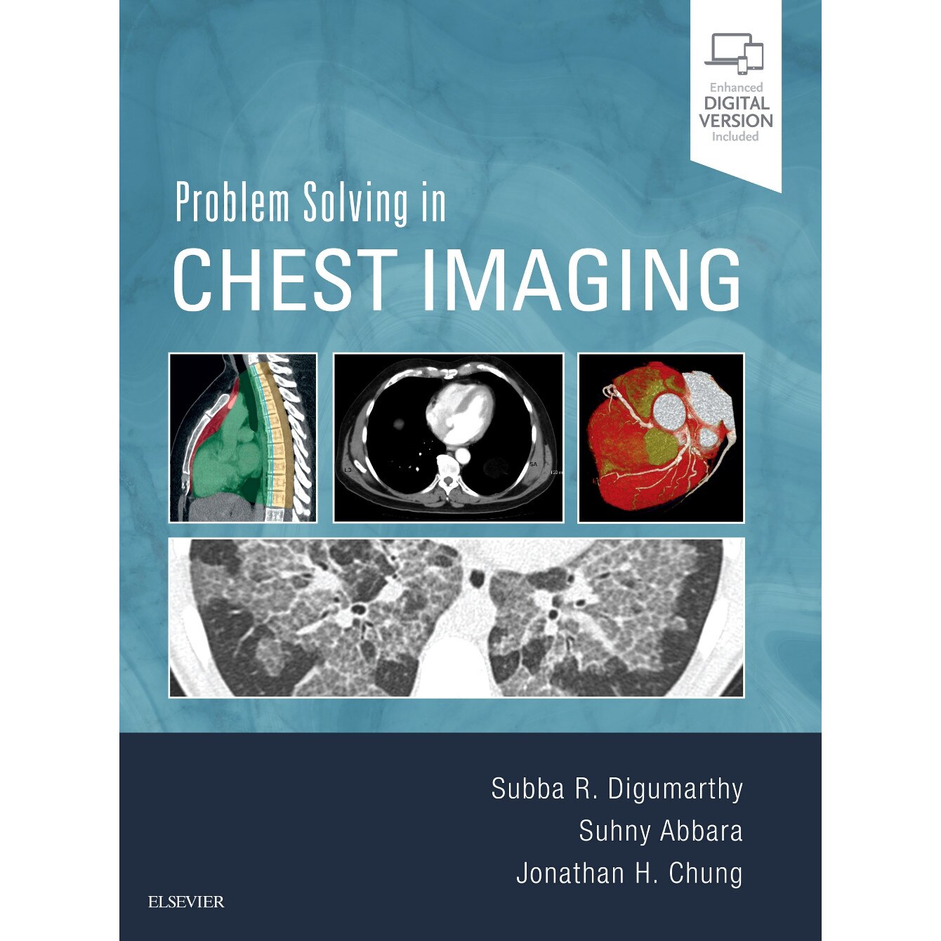 Problem Solving in Chest Imaging de Subba R. Digumarthy