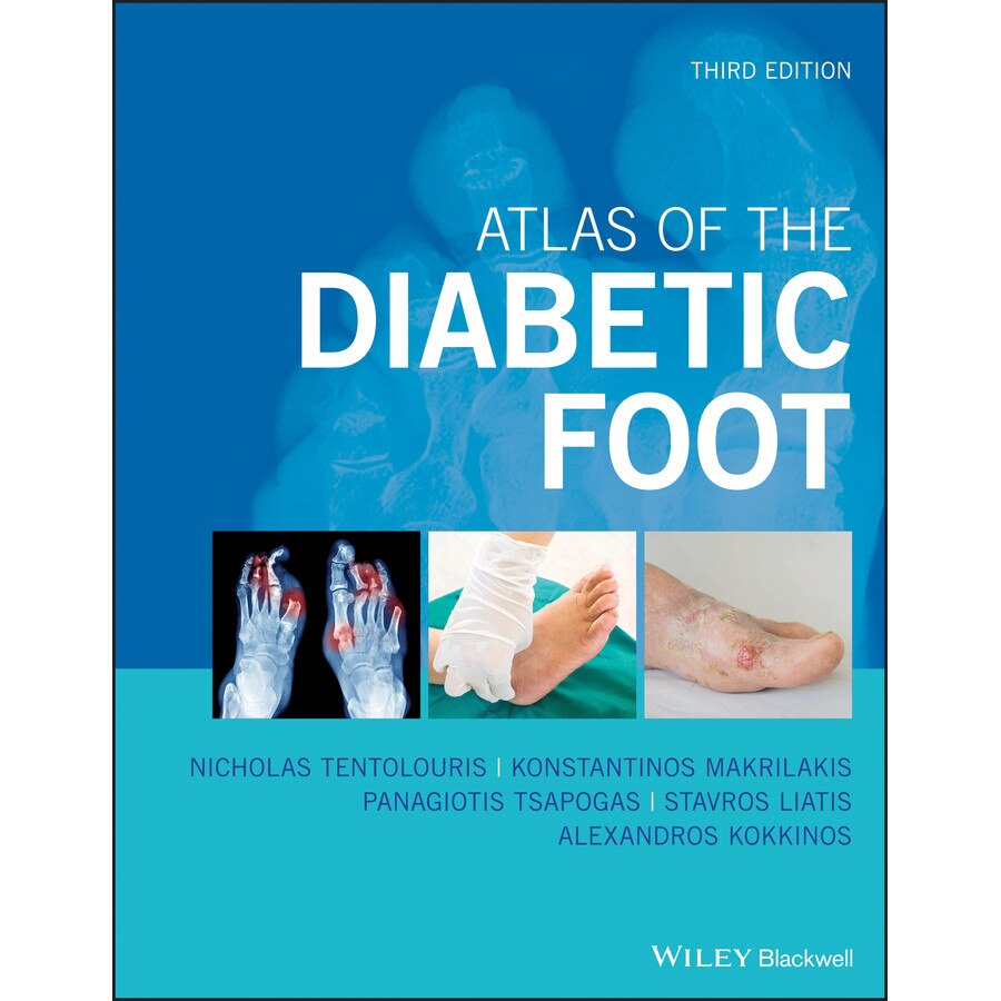 Atlas of the Diabetic Foot de Ioanna Eleftheriadou