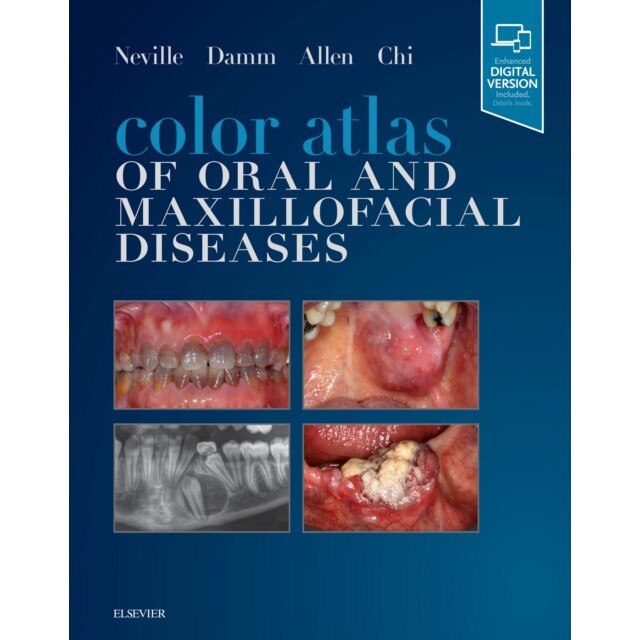 Color Atlas of Oral and Maxillofacial Diseases de Brad W. Neville