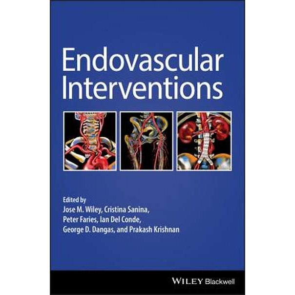 Endovascular Interventions de Jose M. Wiley