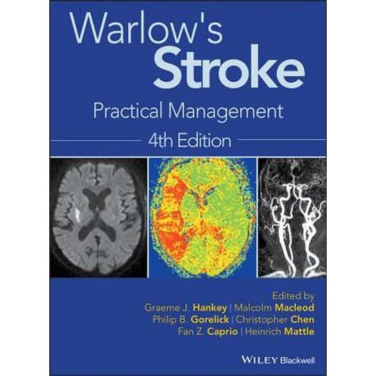 Warlow′s Stroke de Graeme J. Hankey