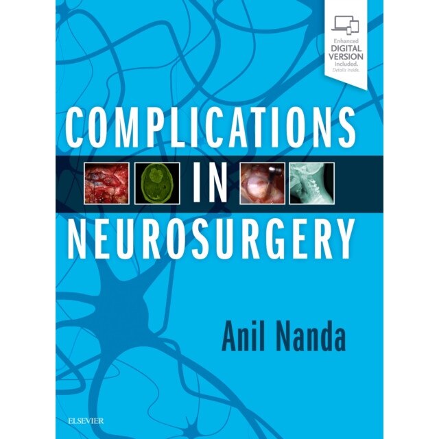 Complications in Neurosurgery de Anil Nanda