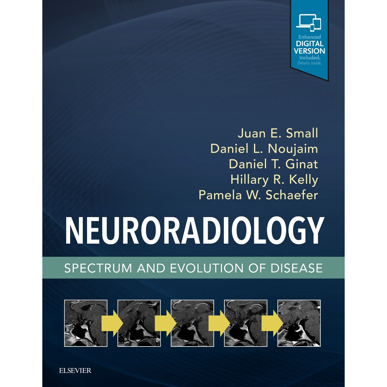 Neuroradiology: Spectrum and Evolution of Disease de Juan E. Small