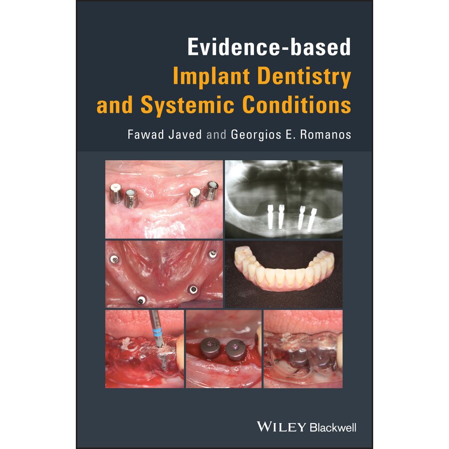 Evidence/-/based Implant Dentistry and Systemic Conditions de Fawad Javed