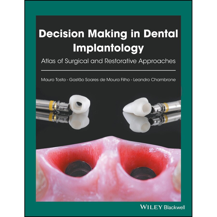 Decision Making in Dental Implantology de Mauro Tosta