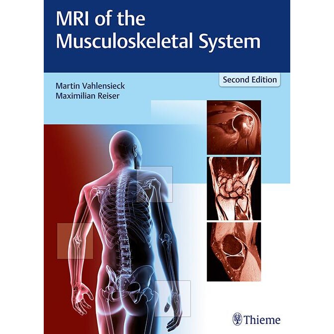 MRI of the Musculoskeletal System de Martin Vahlensieck