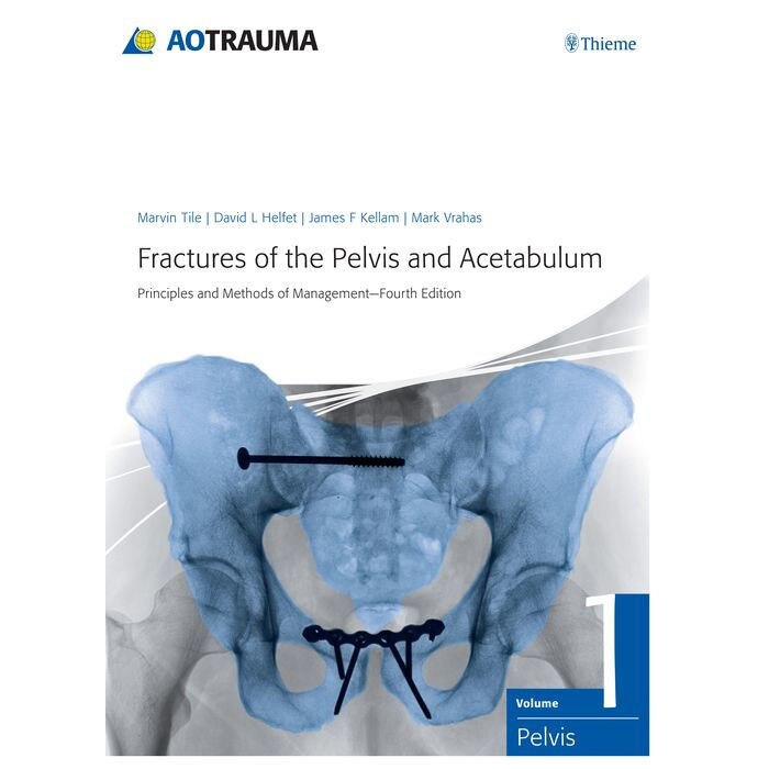Fractures of the Pelvis and Acetabulum de Marvin Tile