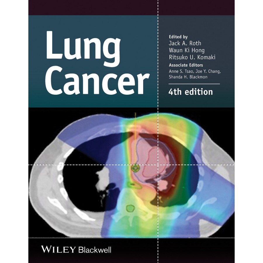 Lung Cancer de Jack A. Roth