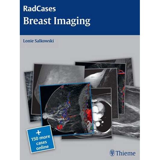 Breast Imaging de Lonie L. Salkowski
