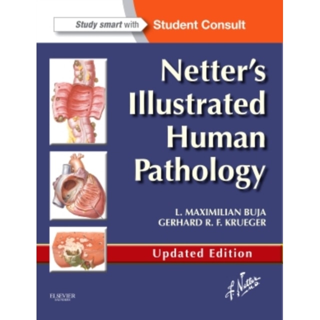 Netter's Illustrated Human Pathology Updated Edition de L. Maximilian Buja