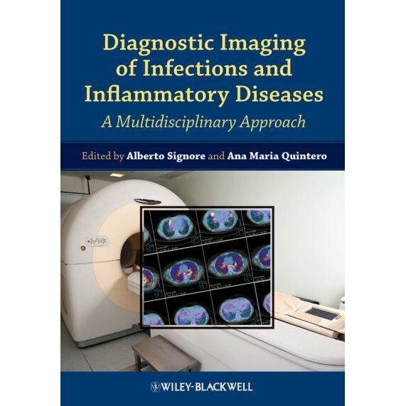 Diagnostic Imaging of Infections and Inflammatory Diseases de Alberto Signore