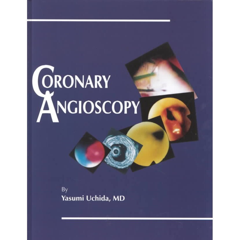 Coronary Angioscopy de Yasumi Uchida, MD
