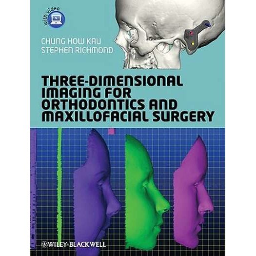 Three/-/Dimensional Imaging for Orthodontics and Maxillofacial Surgery de Chung H. Kau