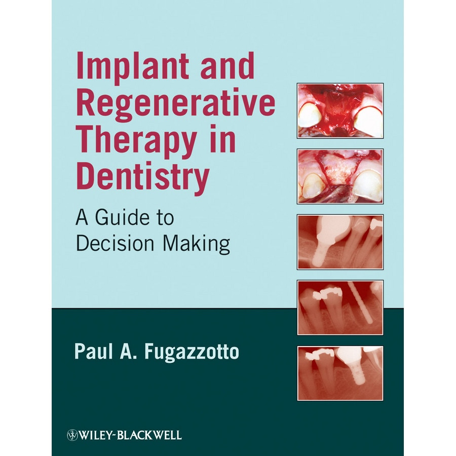 Implant and Regenerative Therapy in Dentistry de Paul A. Fugazzotto