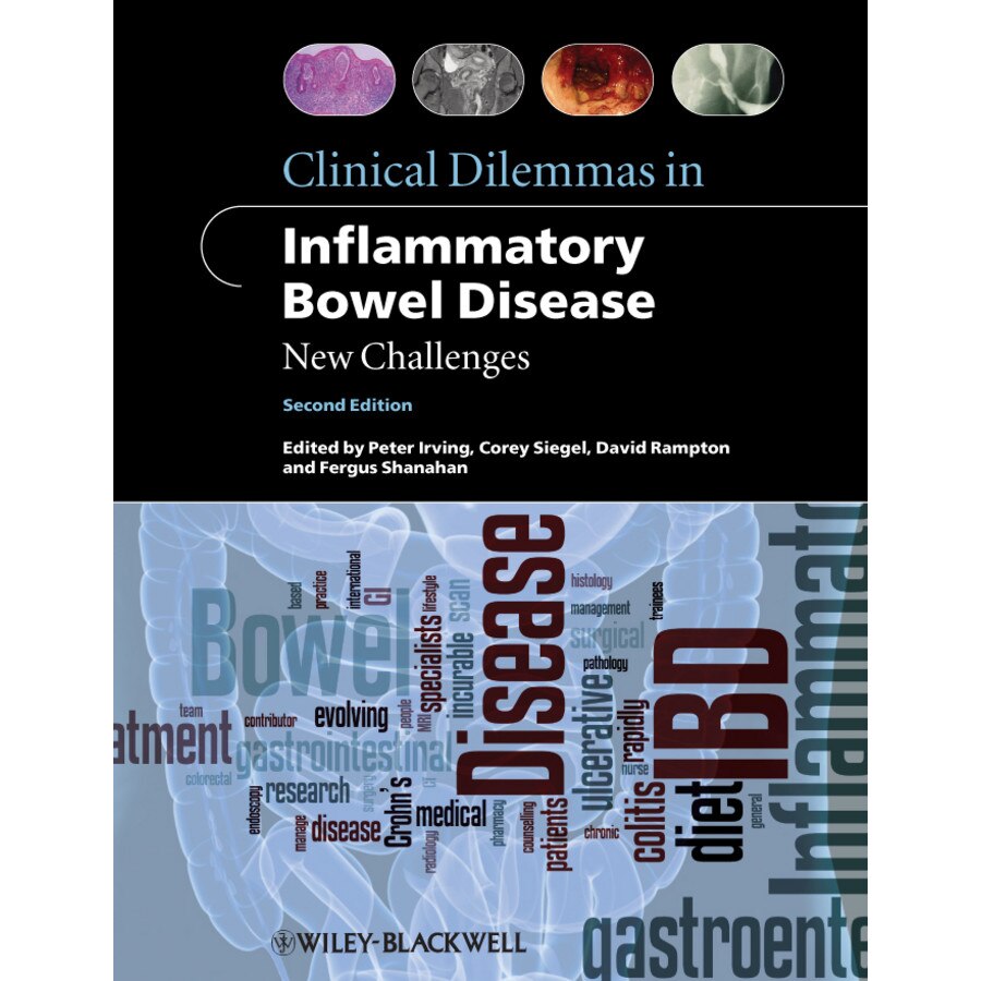 Clinical Dilemmas in Inflammatory Bowel Disease de Peter Irving, MD, MRCP