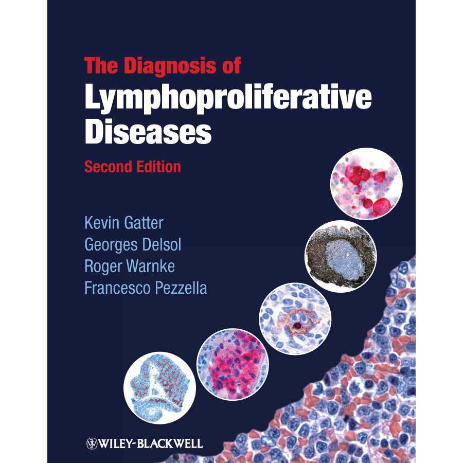 The Diagnosis of Lymphoproliferative Diseases de Kevin Gatter