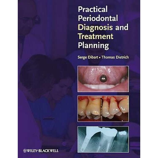 Practical Periodontal Diagnosis and Treatment Planning de Serge Dibart