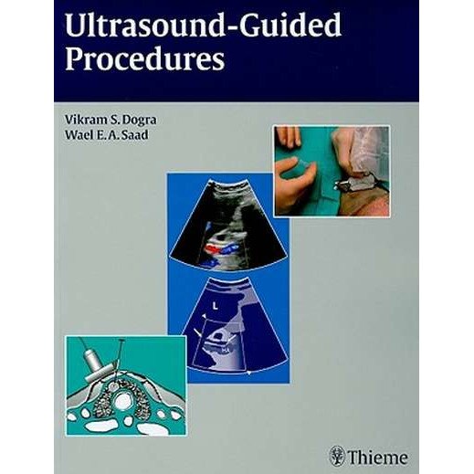 Ultrasound-Guided Procedures de Vikram S. Dogra