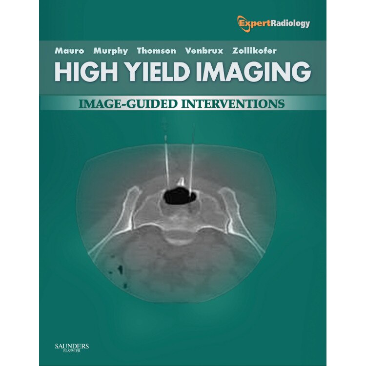 High-Yield Imaging: Interventional de Charles Burke