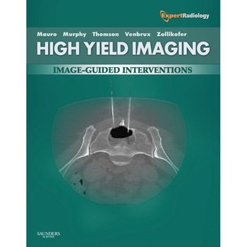 High-Yield Imaging: Interventional de Charles Burke High-Yield Imaging: Interventional de Charles Burke