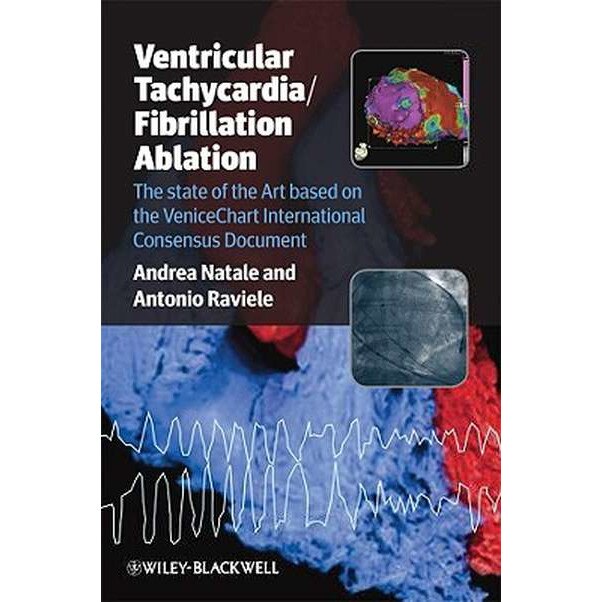 Ventricular Tachycardia / Fibrillation Ablation de Andrea Natale