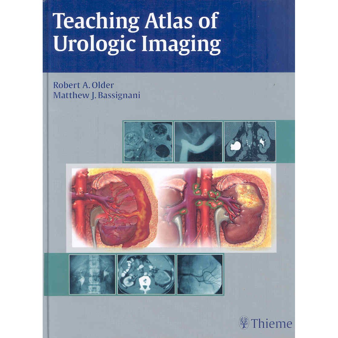 Teaching Atlas of Urologic Imaging de Robert Older
