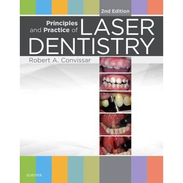 Principles and Practice of Laser Dentistry
