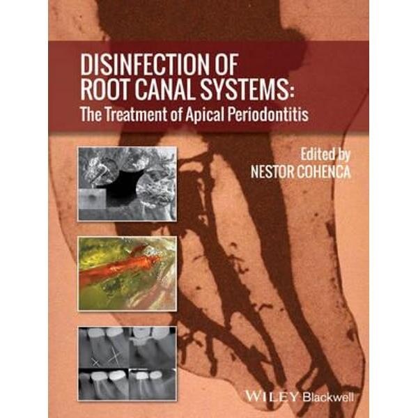 Disinfection of Root Canal Systems