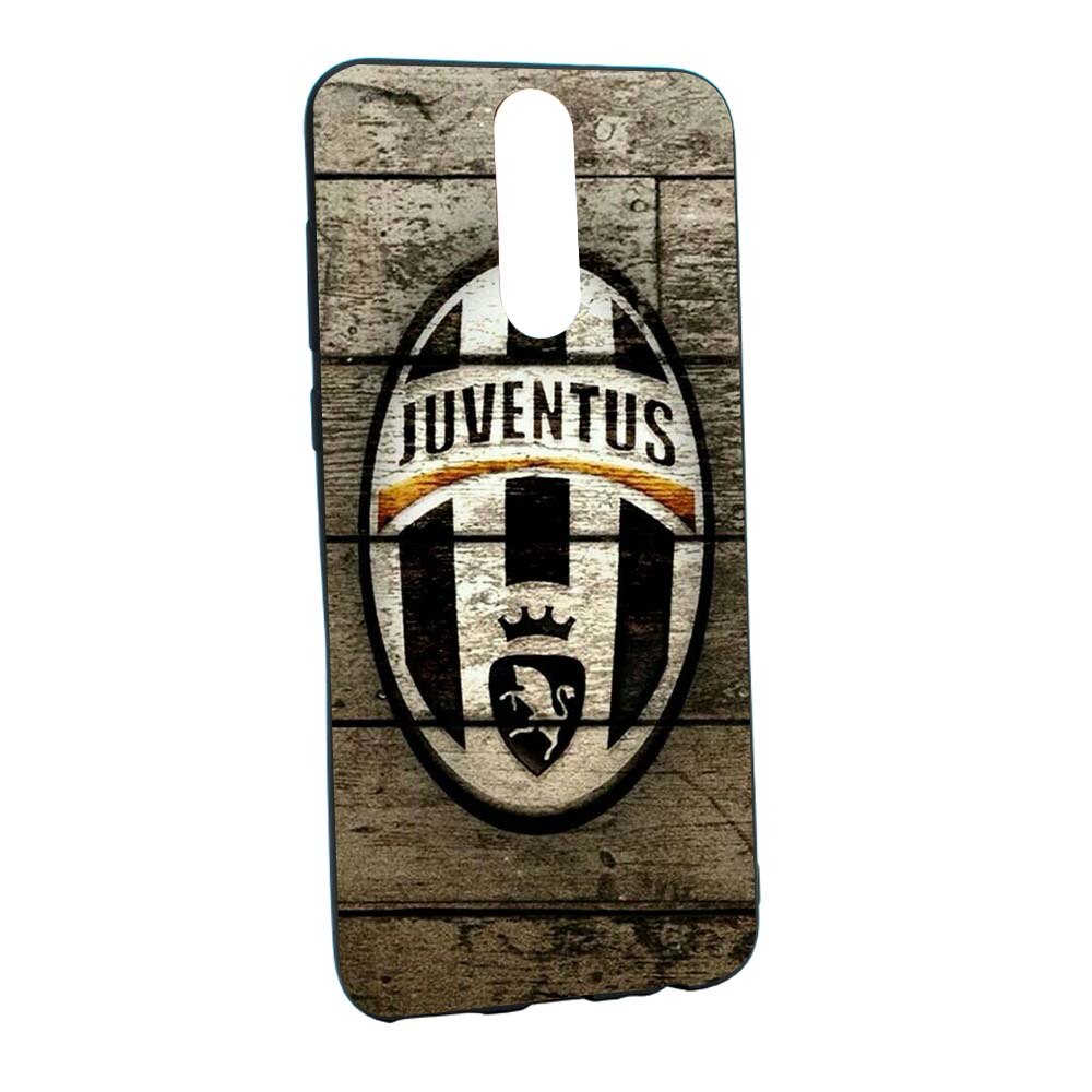 Husa de protectie Football, Juventus pentru Huawei Mate 10 Lite, rezistenta la uzura, anti-alunecare, din silicon Premium, B228