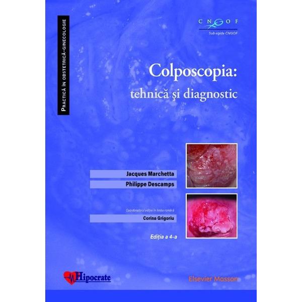 Colposcopia: tehnica si diagnostic - Jacques Marchetta, Philippe Descamps, Corina Grigoriu