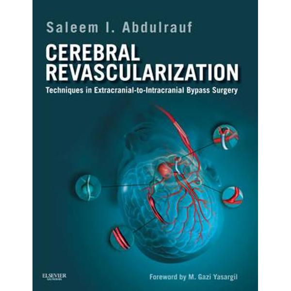 Cerebral Revascularization
