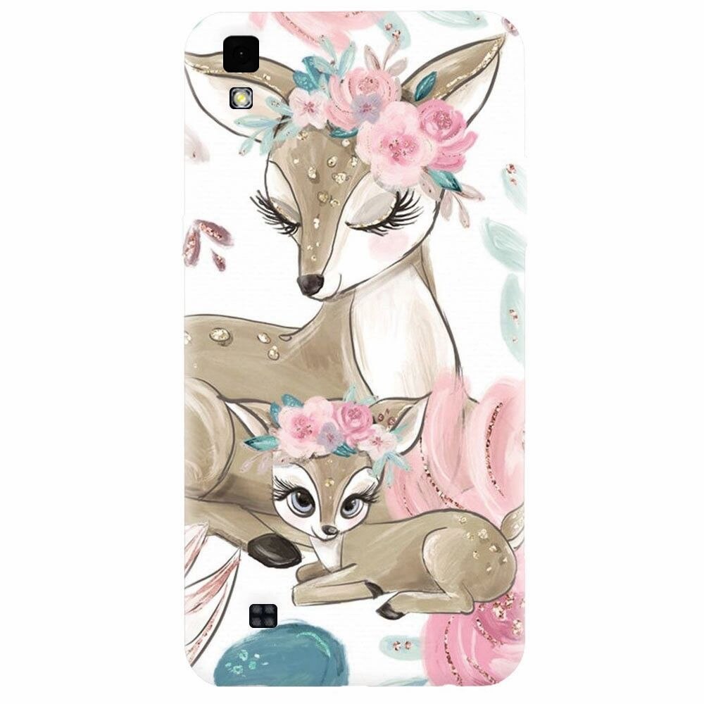 Husa silicon pentru Lg X Power, Deers