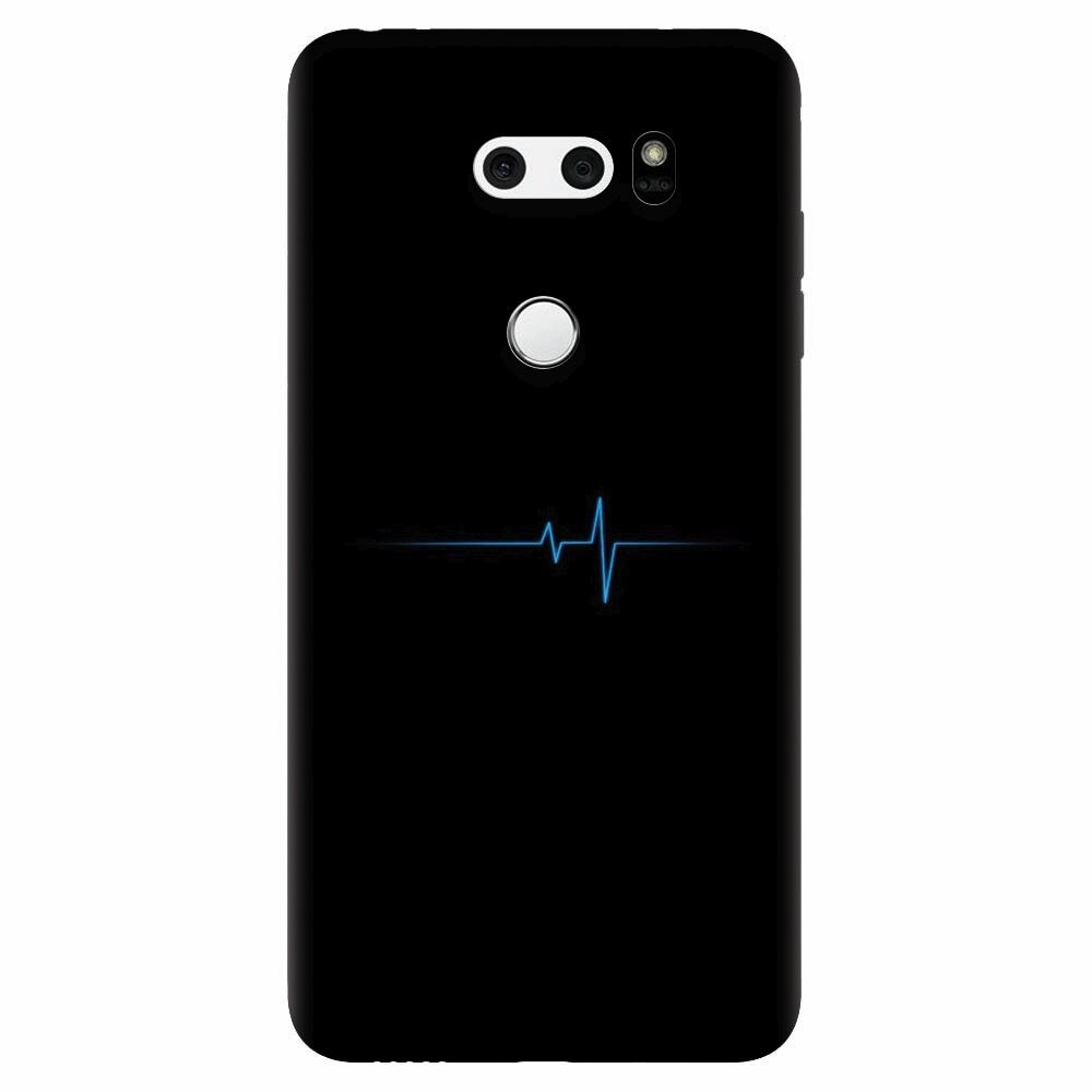 Husa silicon pentru Lg V30, Heartbeat